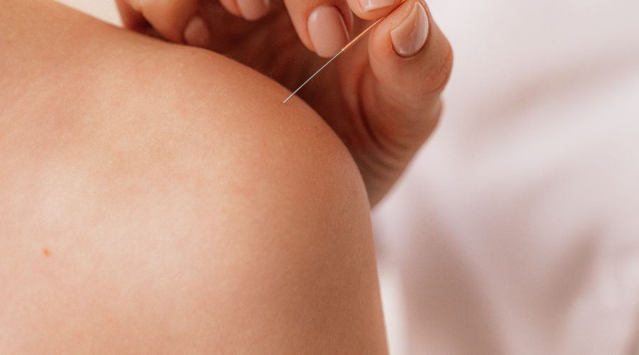What Conditions Can Acupuncture Help You With?