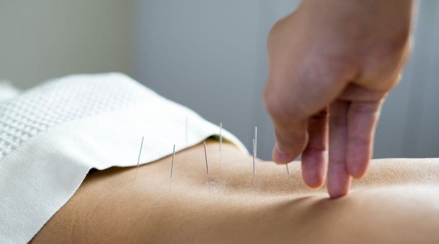 Acupuncture helps various conditions.